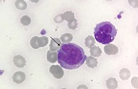 Promonocyte