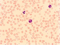 E) peripheral blood