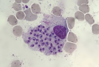 Leishmania amastigote in bone marrow macrophage