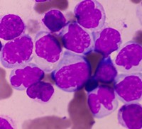 Promonocytes