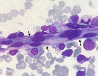 Bone marrow vessel