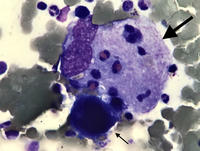 Emperipolesis in Megakaryocyte