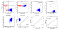 Lymphoplasmacytic lymphoma - Flow cytometry