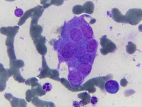 Osteoclast in bone marrow