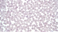 Plasmodium falciparum