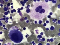 Megakaryocytes-2