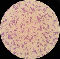 DE111 RETESTT sending full 2