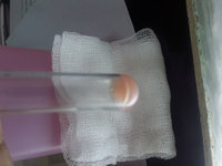 Milky supernatant after centrifugation