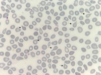 Teardrop cells