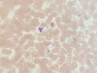 T. cruzi trypomastigote 4