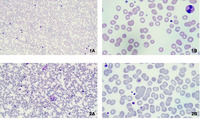 Cold agglutinin disease (CAD), a sneaky condition necessary to be correctly framed