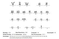 cytogenetics showing translocation t(9:22) q(34;11.2)