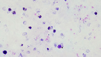 Plasmodium vivax thick film