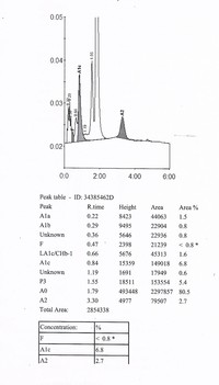 Figure 3. HPLC Chromatogram showing normal pattern