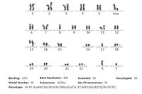 Karyotyping -t(14:18) translocation