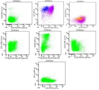 T-Lymphoblastic Lymphoma - Flow Cytometry