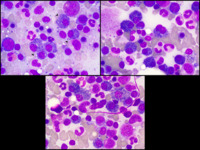 Mott cells