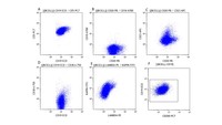 Flow cytometry of the lymph node biopsy