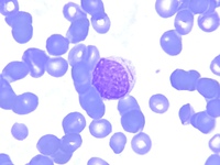 Promyelocyte