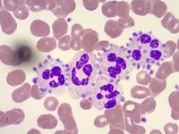Photomicrographs from a Peripheral Blood Smear