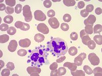 Photomicrographs from a Peripheral Blood Smear