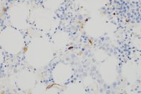 Panel-J, 40X: Negative CD34 staining