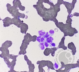 WBC Clumping