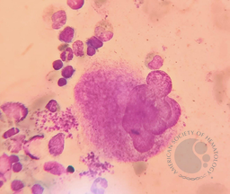 Megakaryocyte producing platelets