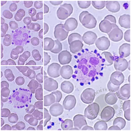 Platelet satellitism