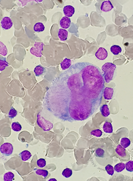 Megakaryocyte