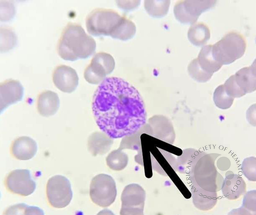 Toxic granulation