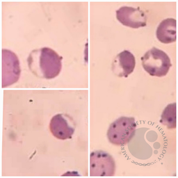 Blister cell