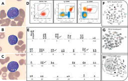 Extranodal presentation of a MYC/BCL6 double-hit lymphoma with 11q aberration in an older patient