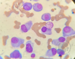 Plasma cell