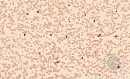Nucleated Red Blood Cells