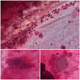 Pneumocystis 1