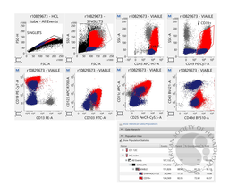 Hairy cell -flowcytometry findings
