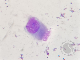 Nasal ciliated epithelial cell