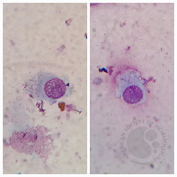 Goblet Cells
