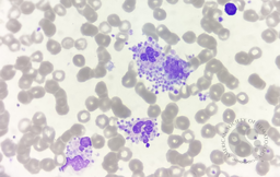 Platelet satellitism around leucocytes 1