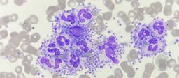 Platelet satellitism around leucocytes 2