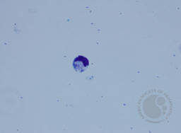 lymphocyte ingulfing bacteria 5