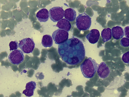 Binuclear Mott Cell