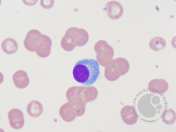 Plasma cell