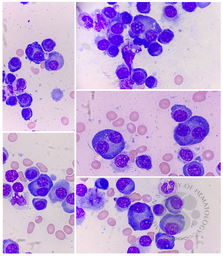 Binucleated plasma cells