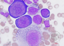 Parvovirus B19 infection 2