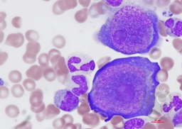 Parvovirus B19 infection 3