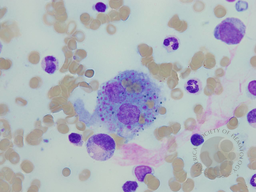 Erythrophagocytosis