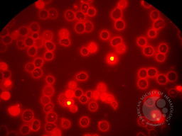C. Fluorescence microscopy, 100x