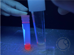 D. Amniotic fluid under ultraviolet exposure